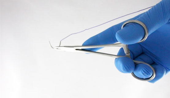 Хирургический шовный материал Алматы